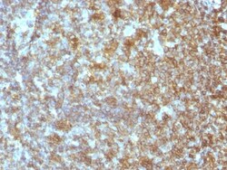 CD45RA Antibody (SPM504), Novus Biologicals 0.2mg; Unlabeled:Antibodies,